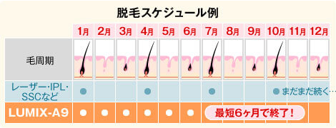 脱毛スケジュール例